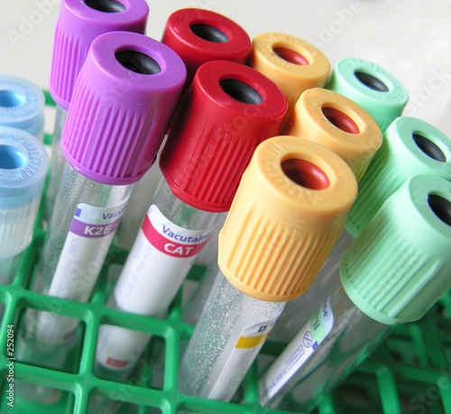 tubes