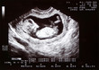 new life, 2d echo