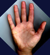 hand rechts
