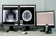 computed tomography computed tomography