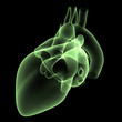 heart x-ray 2
