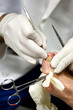 podiatric surgery 3 podiatric surgery 3