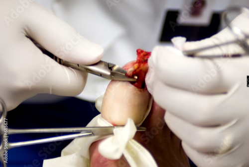Photo: podiatric surgery 1 podiatric surgery 1