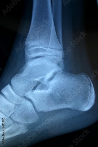 radiographie