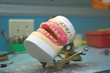dentures 02