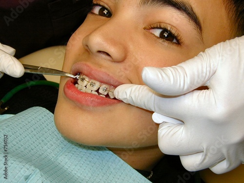 braces