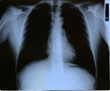 radiographie radiographie