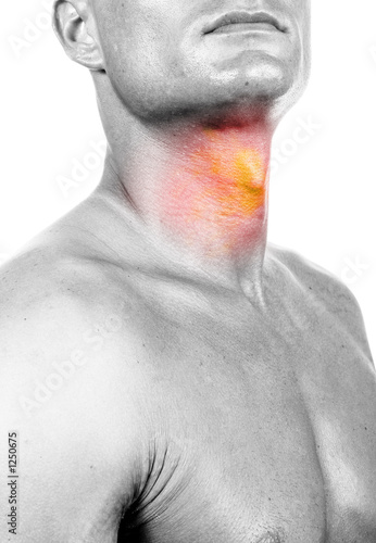 sore throat