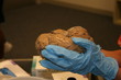 brain in plain view