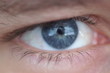 eye