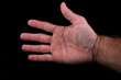 five fingers