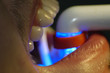 at dentist