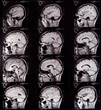 brain tomography