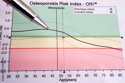 pen showing diagram on osteoporosis risk pen showing diagram on osteoporosis risk