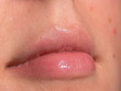 natürliche lippen natürliche lippen