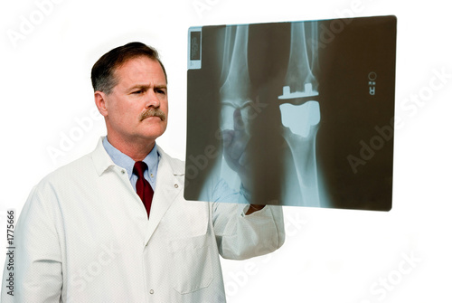 Photo: titanium knee replacement titanium knee replacement