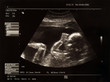 Bild von einem Baby im Bauch der Mutter