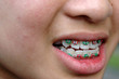 smile