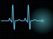 ecg