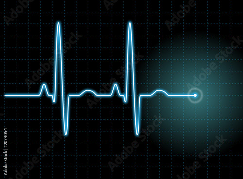 ecg