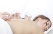 massage schröpfen