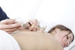 massage schröpfen