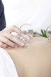 massage schröpfen