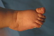 foot