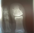 xray