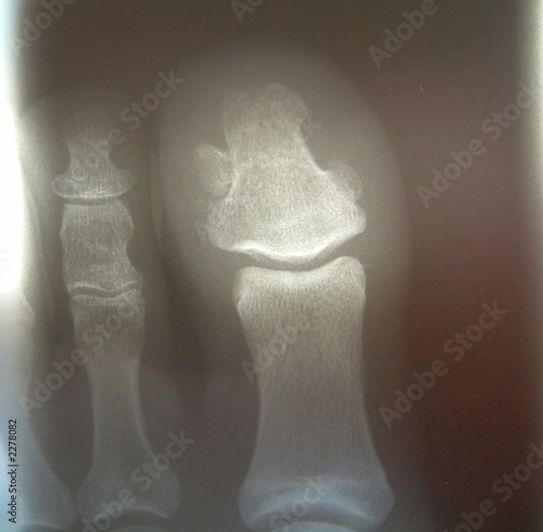 Photo: xray xray