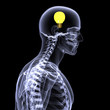 skeleton x-ray - idea 2