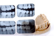 Photo en ligne au meilleur prix dental  x-ray