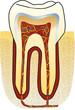 dente
