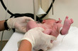 delivery baby