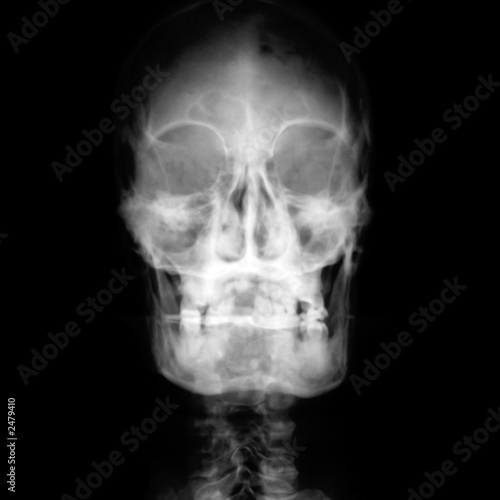 Photo: x-ray head x-ray head