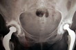 x ray image