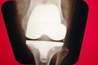 Foto: knee xray knee xray