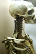 skeleton