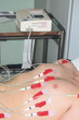ecg