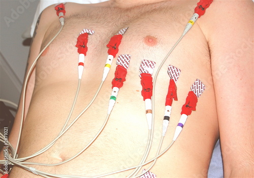 Foto: ecg ecg