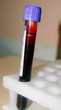 blood test