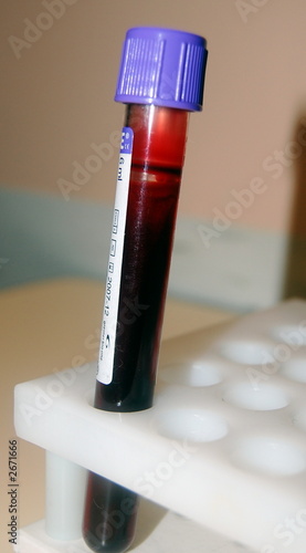 Foto: blood test blood test