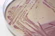 bacterial colonies
