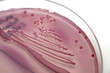 bacterial colonies