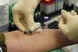 procedure of a  blood capture