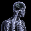 skeleton x-ray - wheels a turning