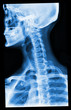 blue xray