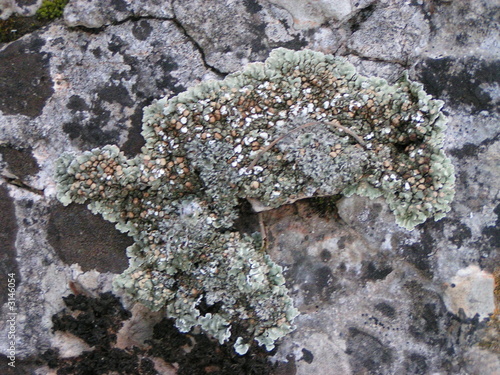 Photo: grey eczema grey eczema