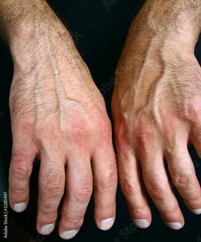 Photo: tired hands tired hands