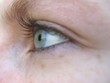 auge